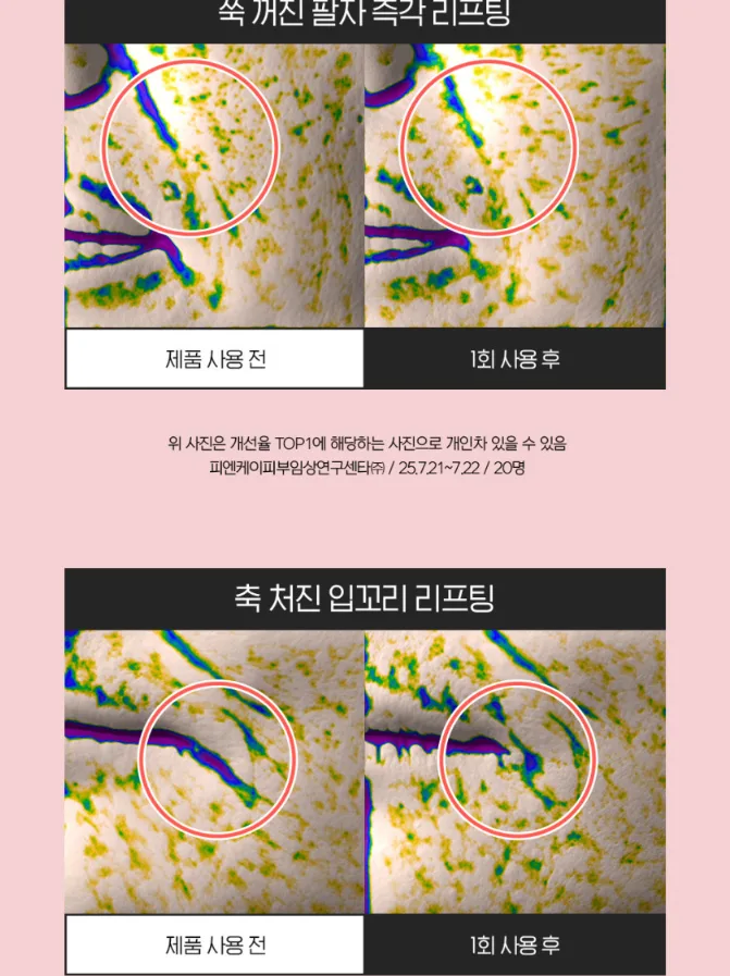 상품코드 : IML005 일루미엘 마이크로니드샷 즉각리프팅 아이&팔자 패치 6매