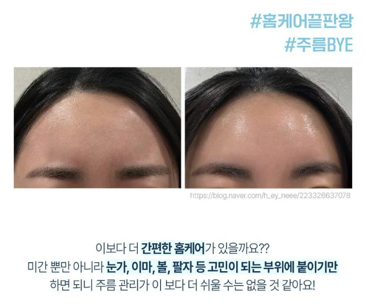 상품코드 : K0386 [라보타치] 미간 팔자 케어 패치 12매 (낱개발주용)