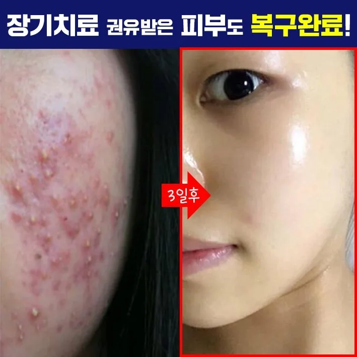 까레넬 히아루 비타5 시카세럼 30ml