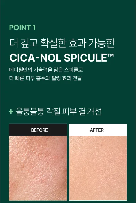 메디필 피토시카재생 비립종 3000샷