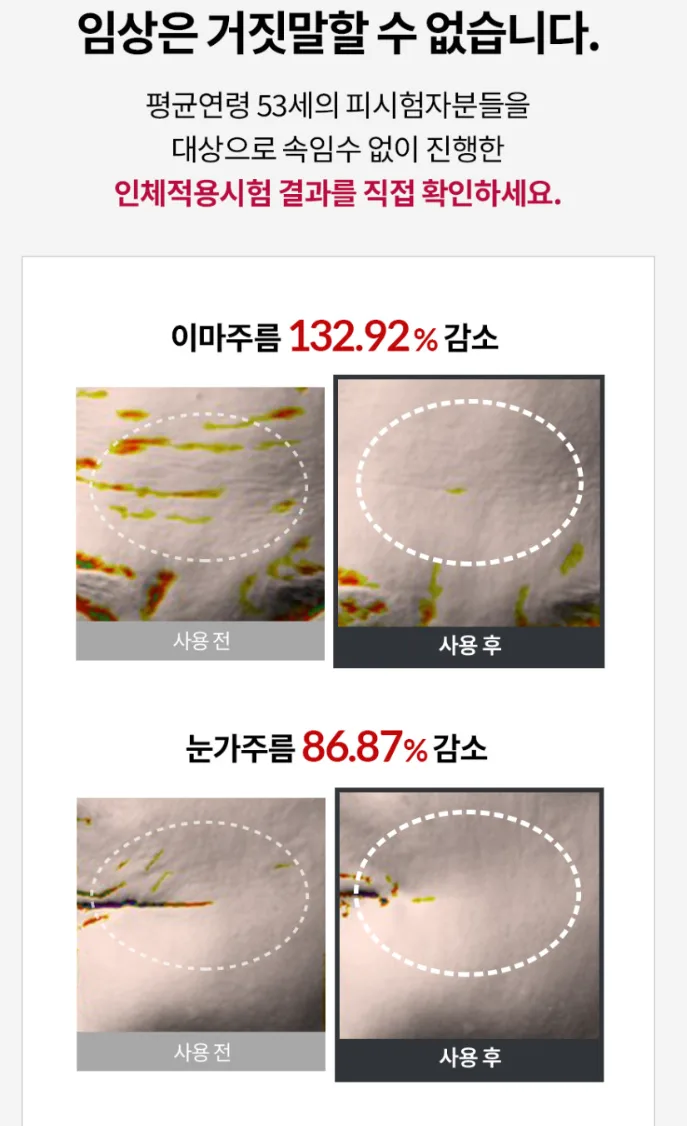 셀비엘 링클레볼루션 필톡스 주름지우개 10ml