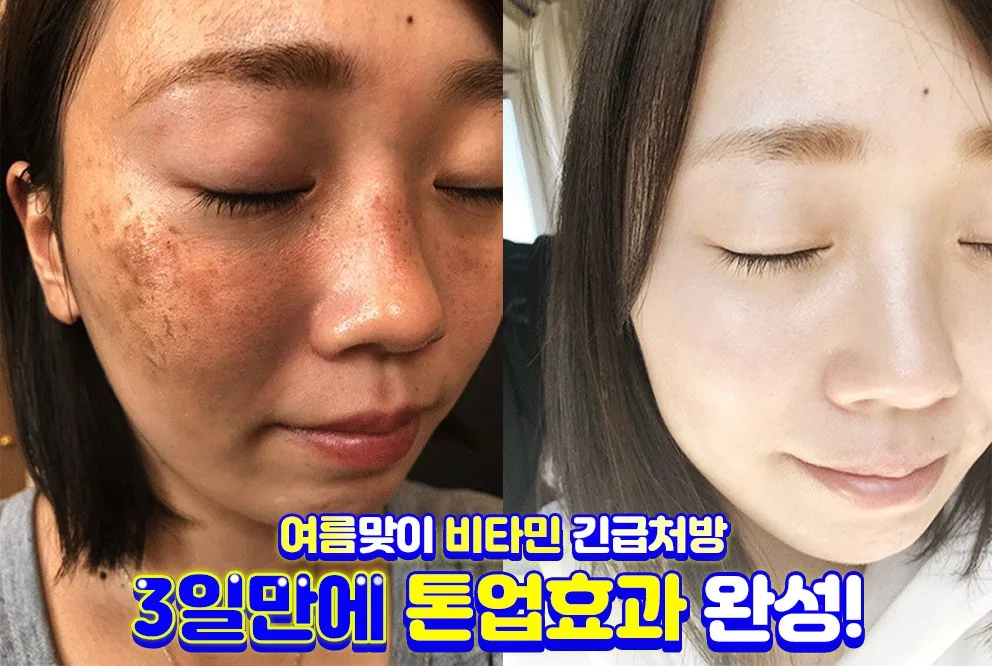 까레넬 기미잡티 안색개선 안티멜라즈마 세럼 30ml