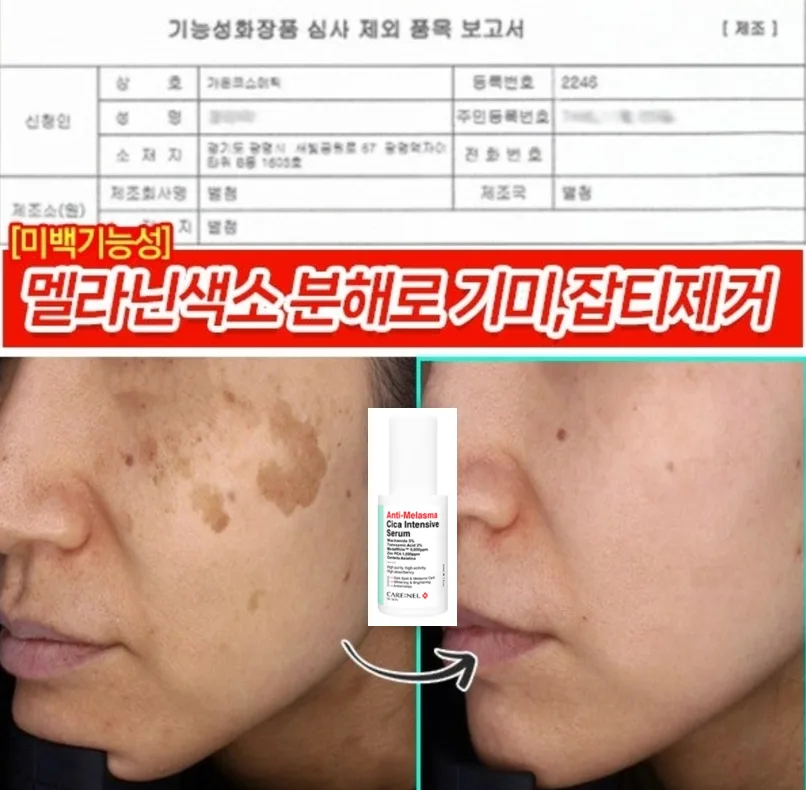 까레넬 기미잡티 안색개선 안티멜라즈마 세럼 30ml