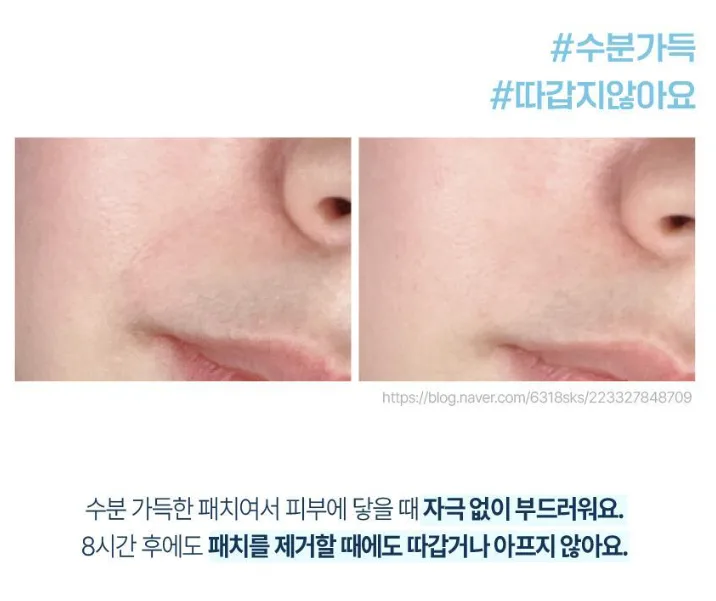 상품코드 : K0386 [라보타치] 미간 팔자 케어 패치 12매 (낱개발주용)