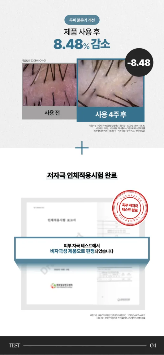 상품코드 : DNP001 [더나플러스] 그린테라피 탈모앰플 두피 쿨링 케어 두피앰플 12ml